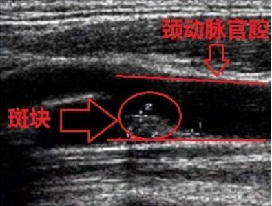 寿与“脉”齐(图2)