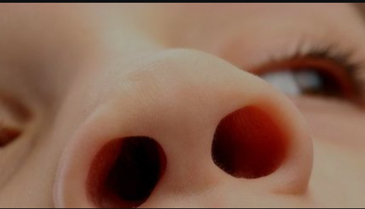 解锁大鼻孔如何配合鼻负压置换技术?(图4) 解锁大鼻孔如何配合鼻负压置换技术?(图4)