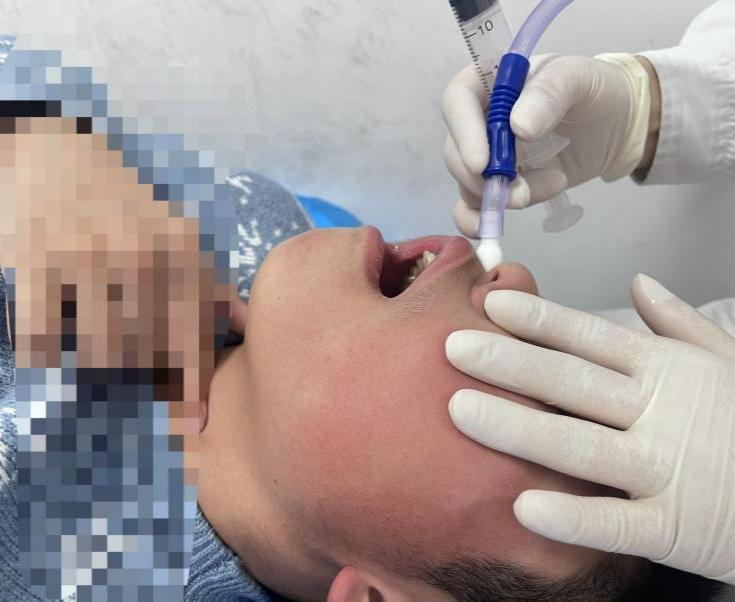 解锁大鼻孔如何配合鼻负压置换技术?(图7) 解锁大鼻孔如何配合鼻负压置换技术?(图7)