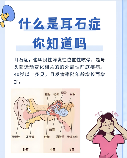 耳朵里的小石头怎么“搬家”?耳石症治疗的妙招(图1) 耳朵里的小石头怎么“搬家”?耳石症治疗的妙招(图1)