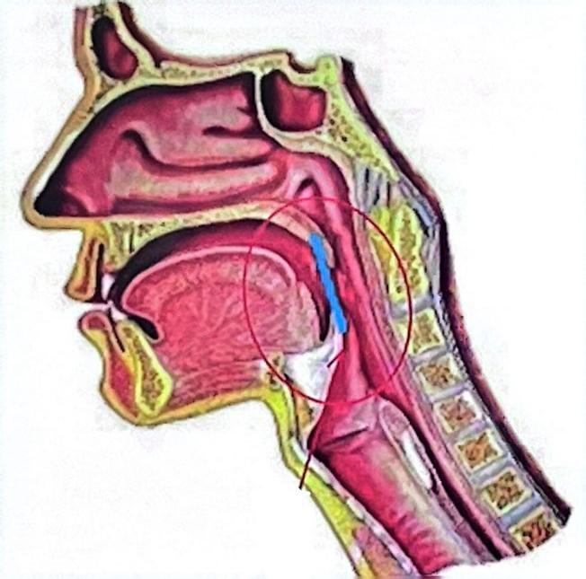 解锁大鼻孔如何配合鼻负压置换技术?(图1)