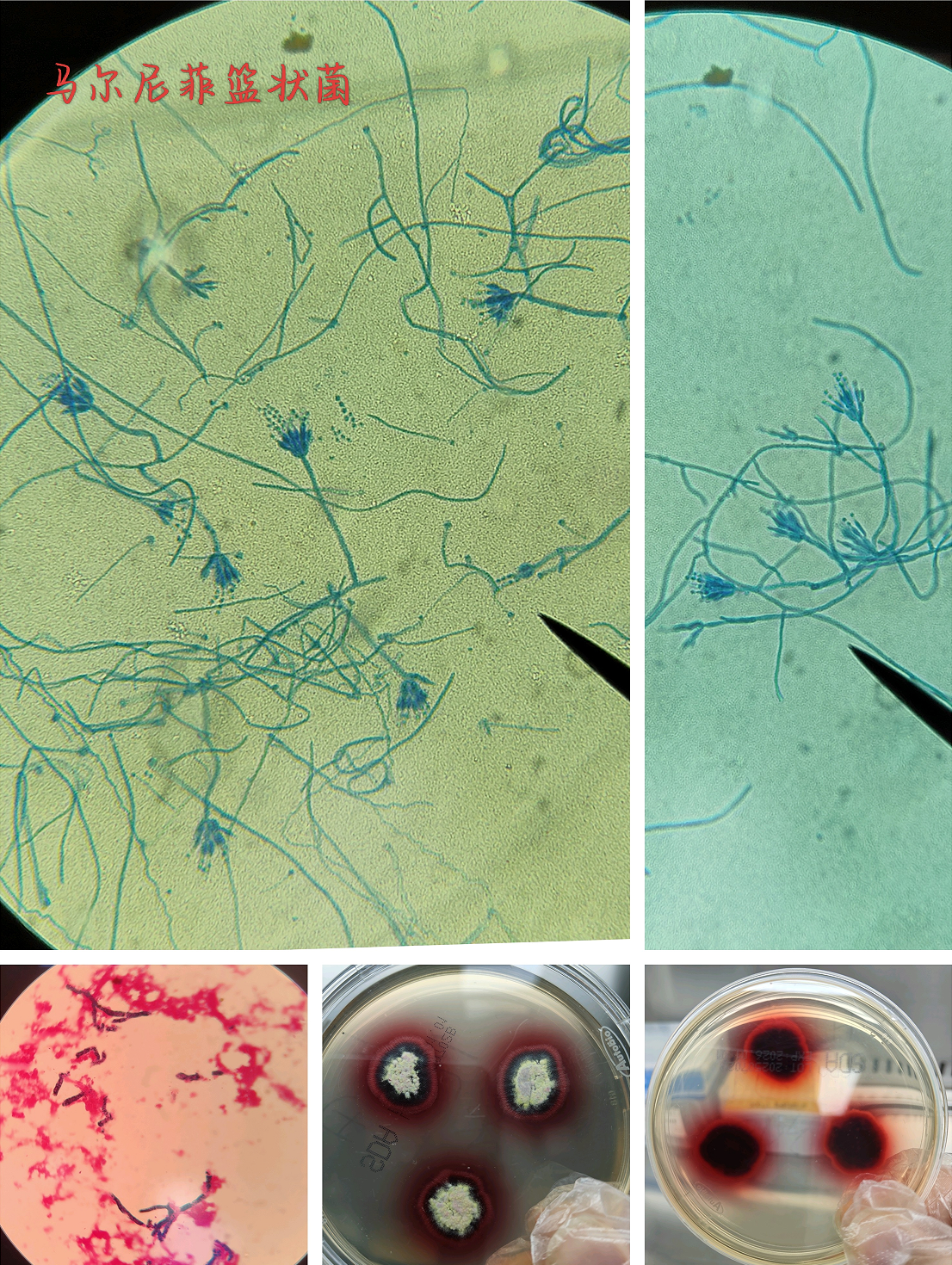 从血培养到诊断警报，检验科如何识别马尔尼菲青霉？(图1)