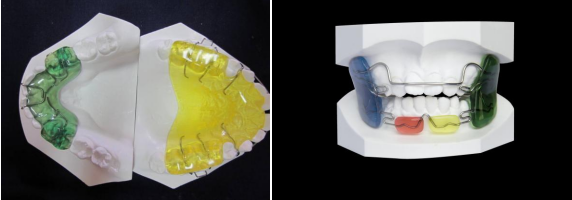 儿童早期矫治的选择和误区(图3) 儿童早期矫治的选择和误区(图3)